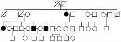 Case report: Flail leg syndrome in familial amyotrophic lateral sclerosis with L144S SOD1 mutation